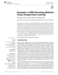 Evaluation of MRI Denoising Methods Using Unsupervised Learning